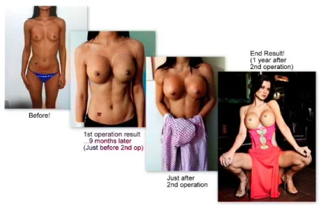 Jamine Jae surgery.webp Jamine Jae surgery.webp